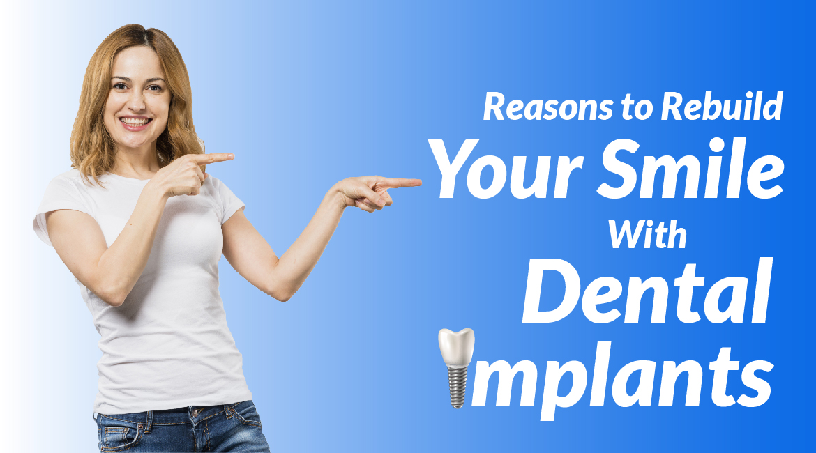 Reasons to Rebuild Your Smile With Dental Implants